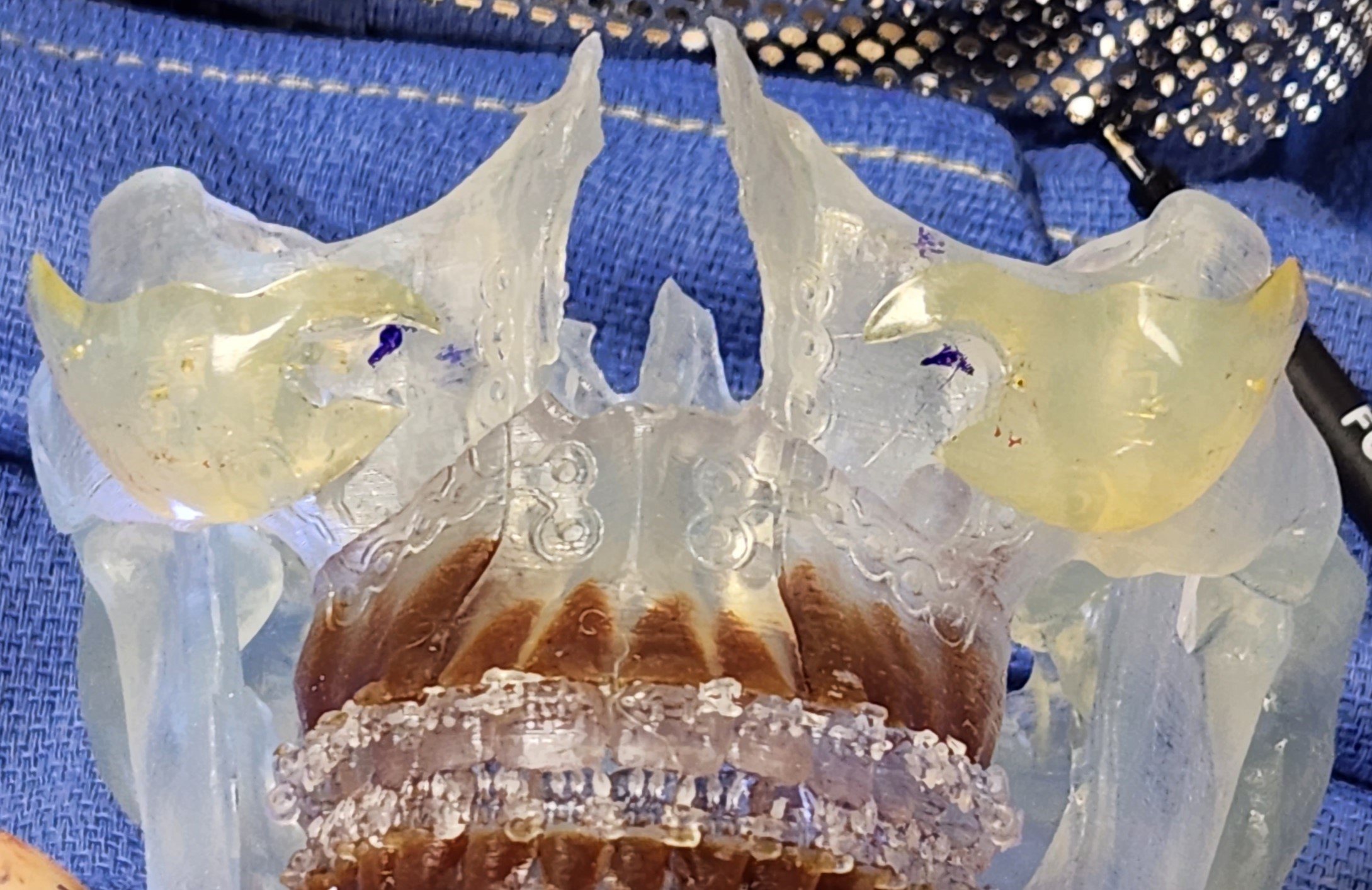 <p>Silicone Malar Implants