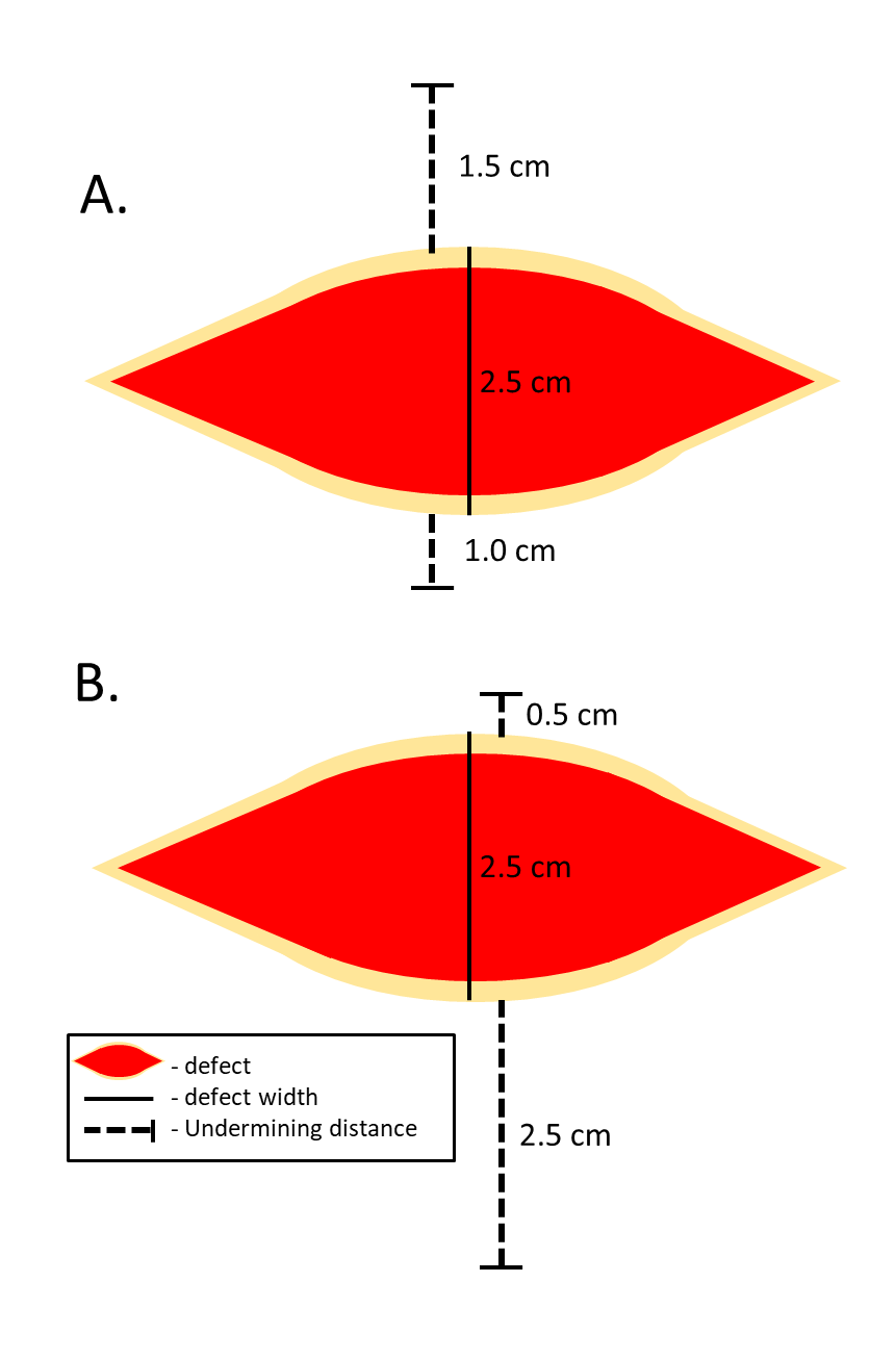 Intermediate versus Complex Closure