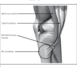 <p>Pes Anserinus Tendons