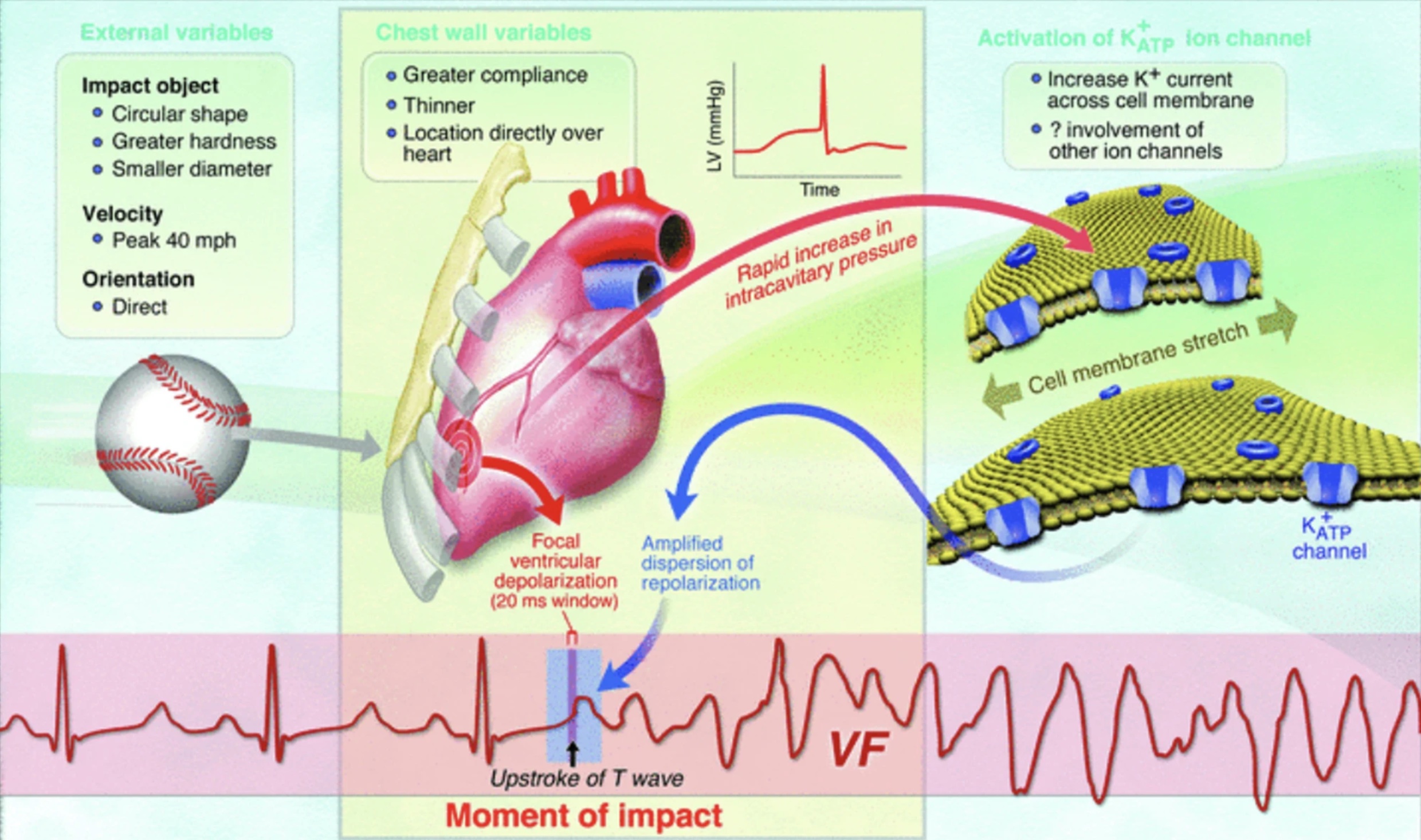 <p>Commotio Cordis