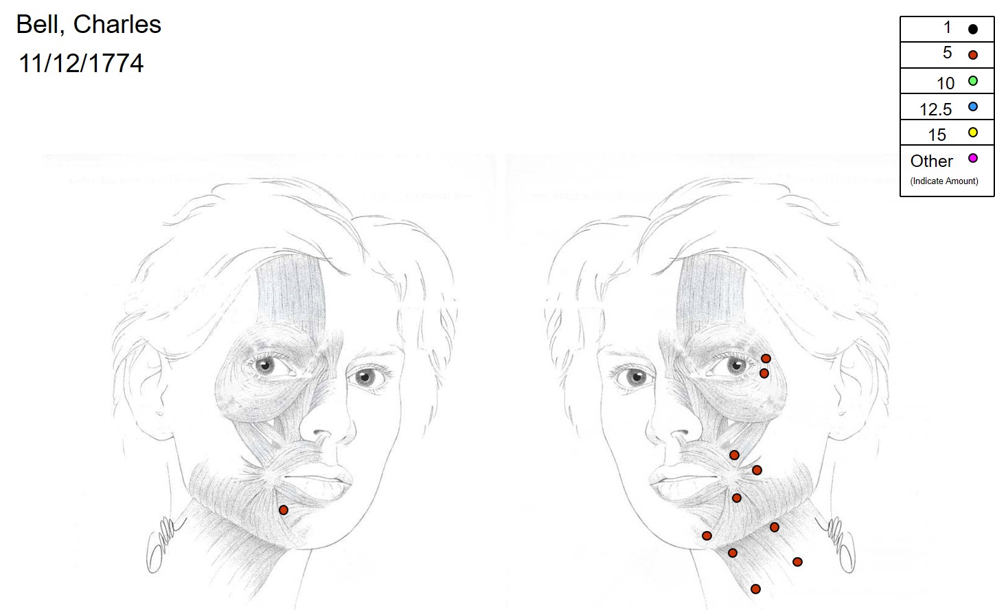 <p>Botulinum Toxin injection for Facial Synkinesis