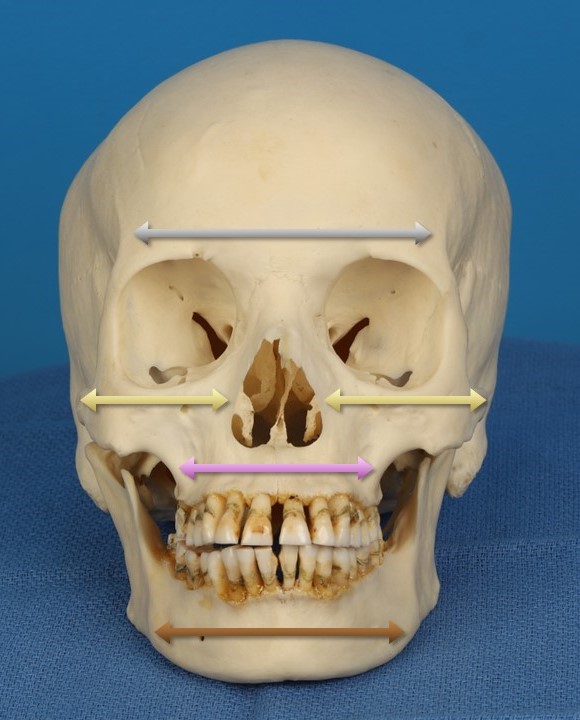 <p>Horizontal Butresses of the Face