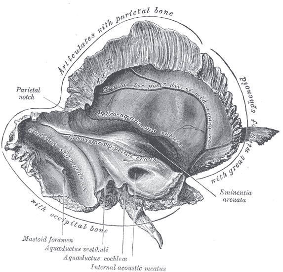 <p>Left Temporal Bone, Inner Surface