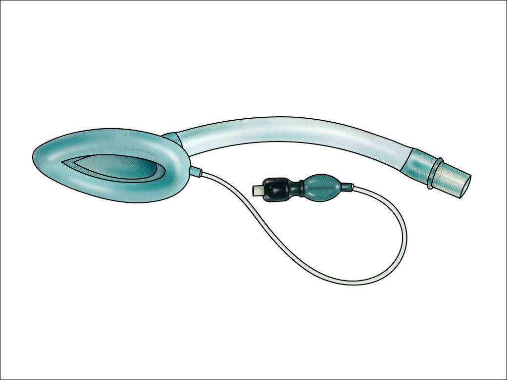 <p>Laryngeal Mask Airway. This illustration shows a laryngeal mask airway.</p>