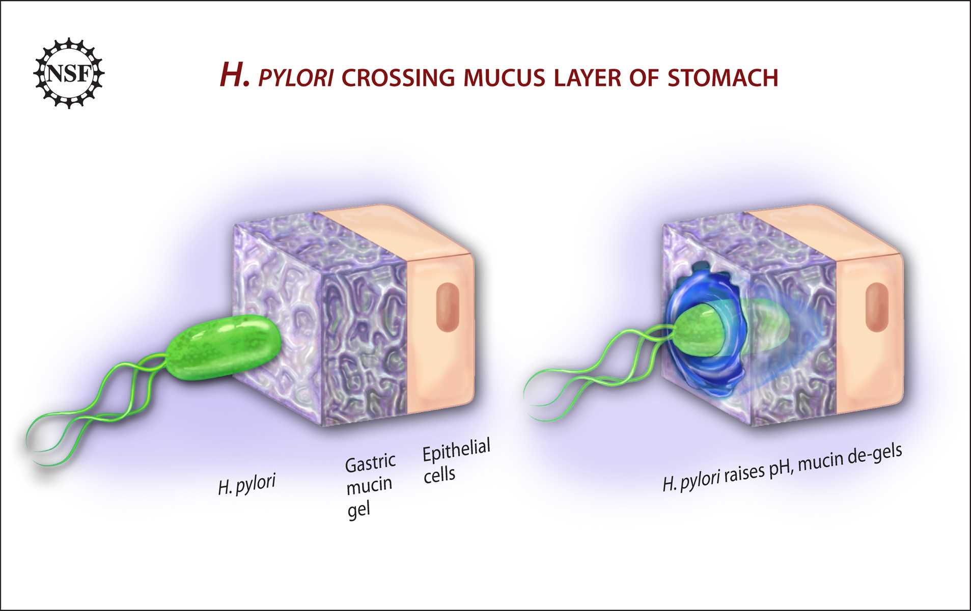 A team of researchers from Boston University, Harvard Medical School and Massachusetts Institute of Technology have shown that the bacterium that causes human stomach ulcers uses a clever biochemical strategy to alter the physical properties of its environment, allowing it to move and survive and further colonize its host