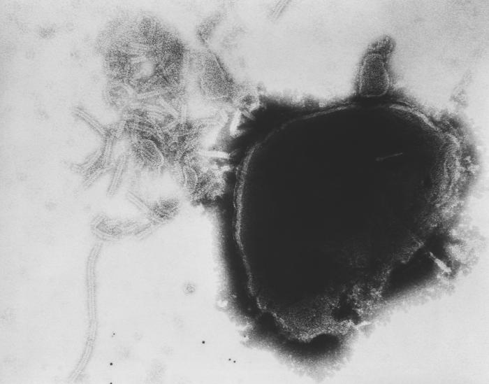 Pathology, Transmission electron micrograph, (TEM), Paramyxovirus virion, viral nucleocapsids, Measles, Mumps, Rubella, Vaccine