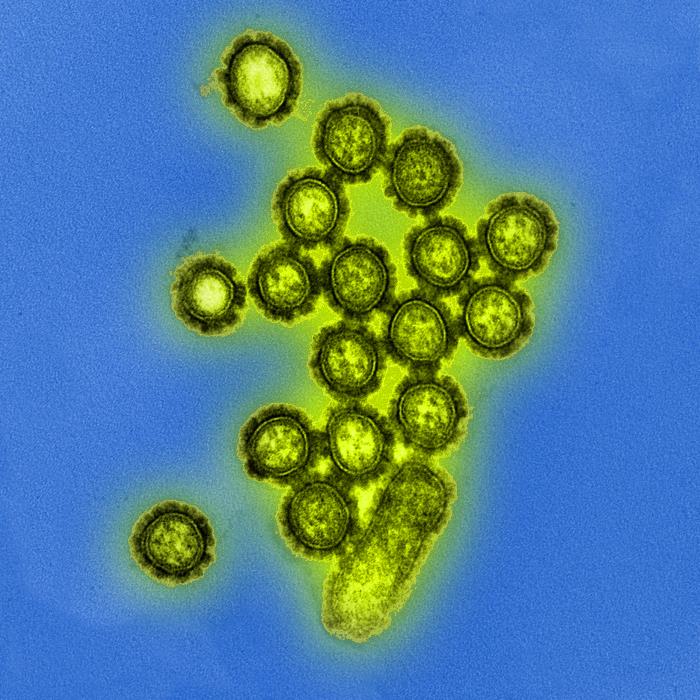 Digitally-colorized transmission electron microscopic (TEM),H1N1 influenza virus particles