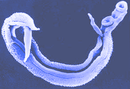 EM of schistosomiasis