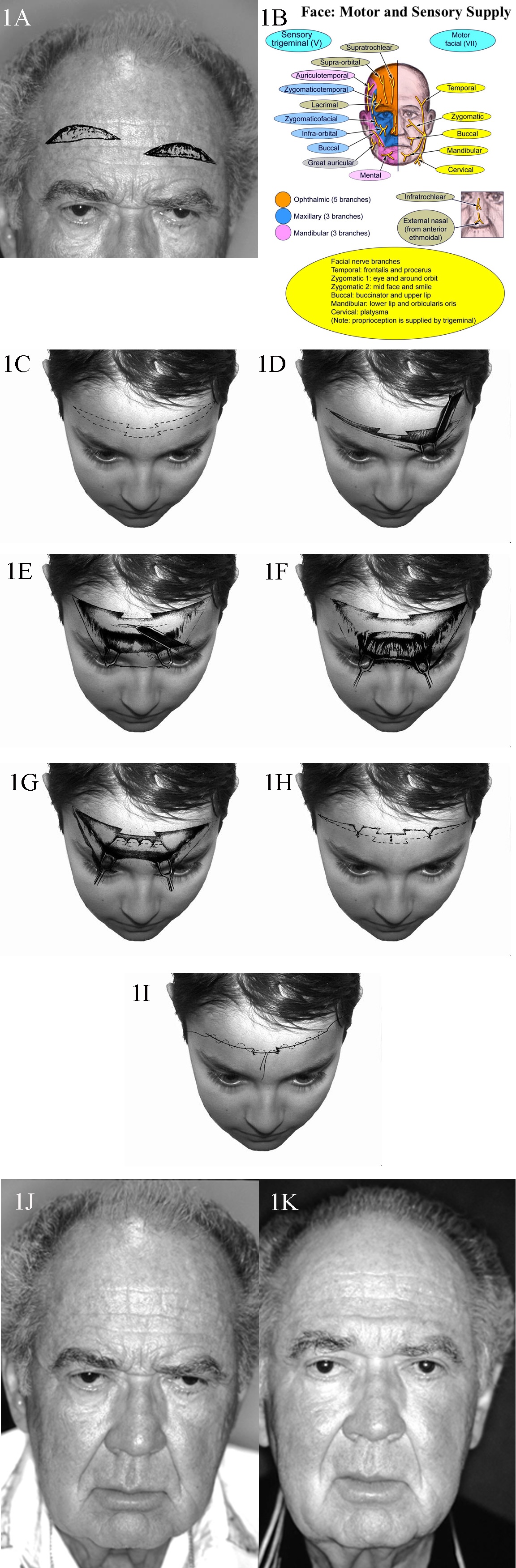 <p>Motor and Sensory Supply, Face