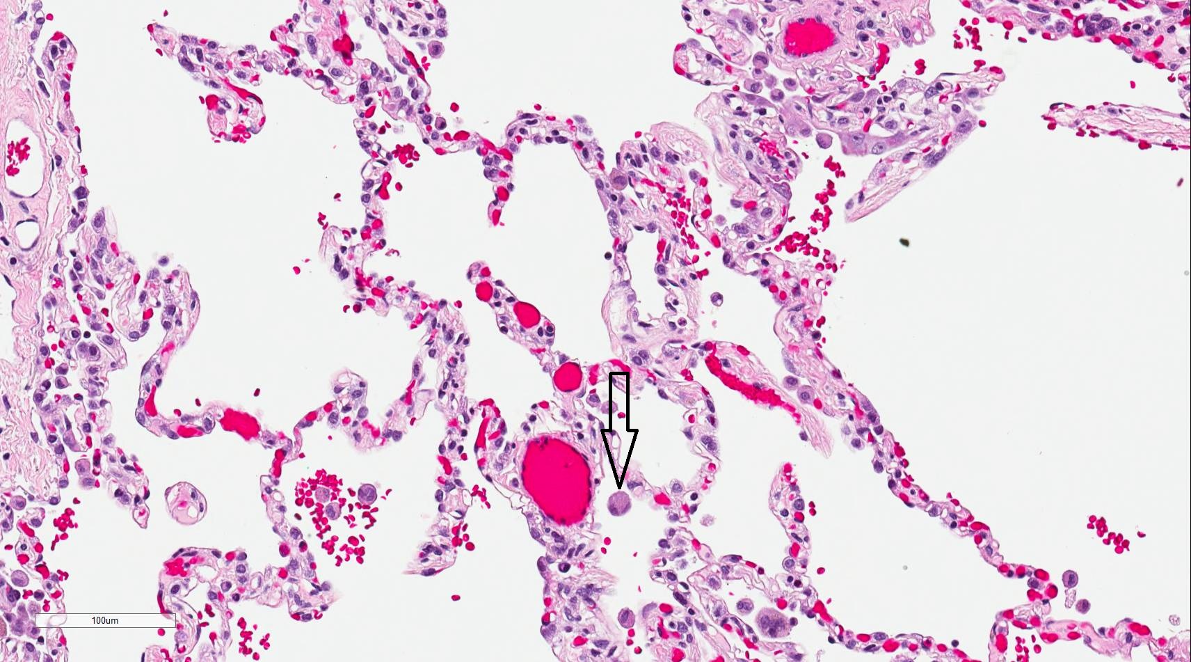 <p>Lung Histology 200&times; Magnification</p>