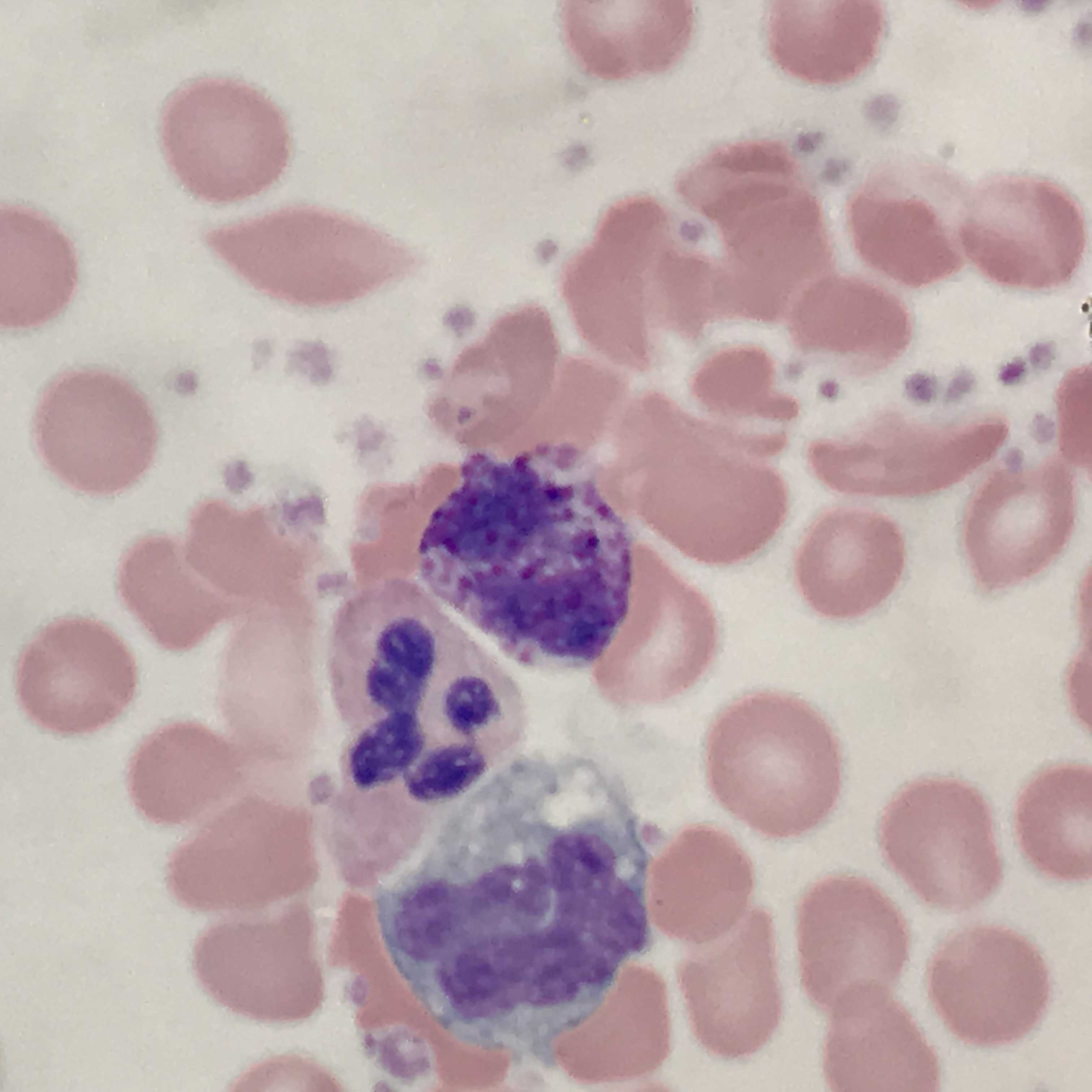 <p>Monocyte, Neutrophil, and Basophil