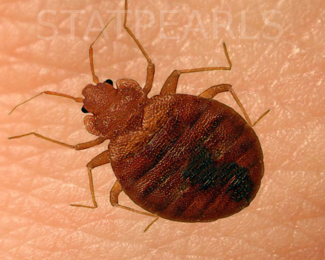 BedBug on skin