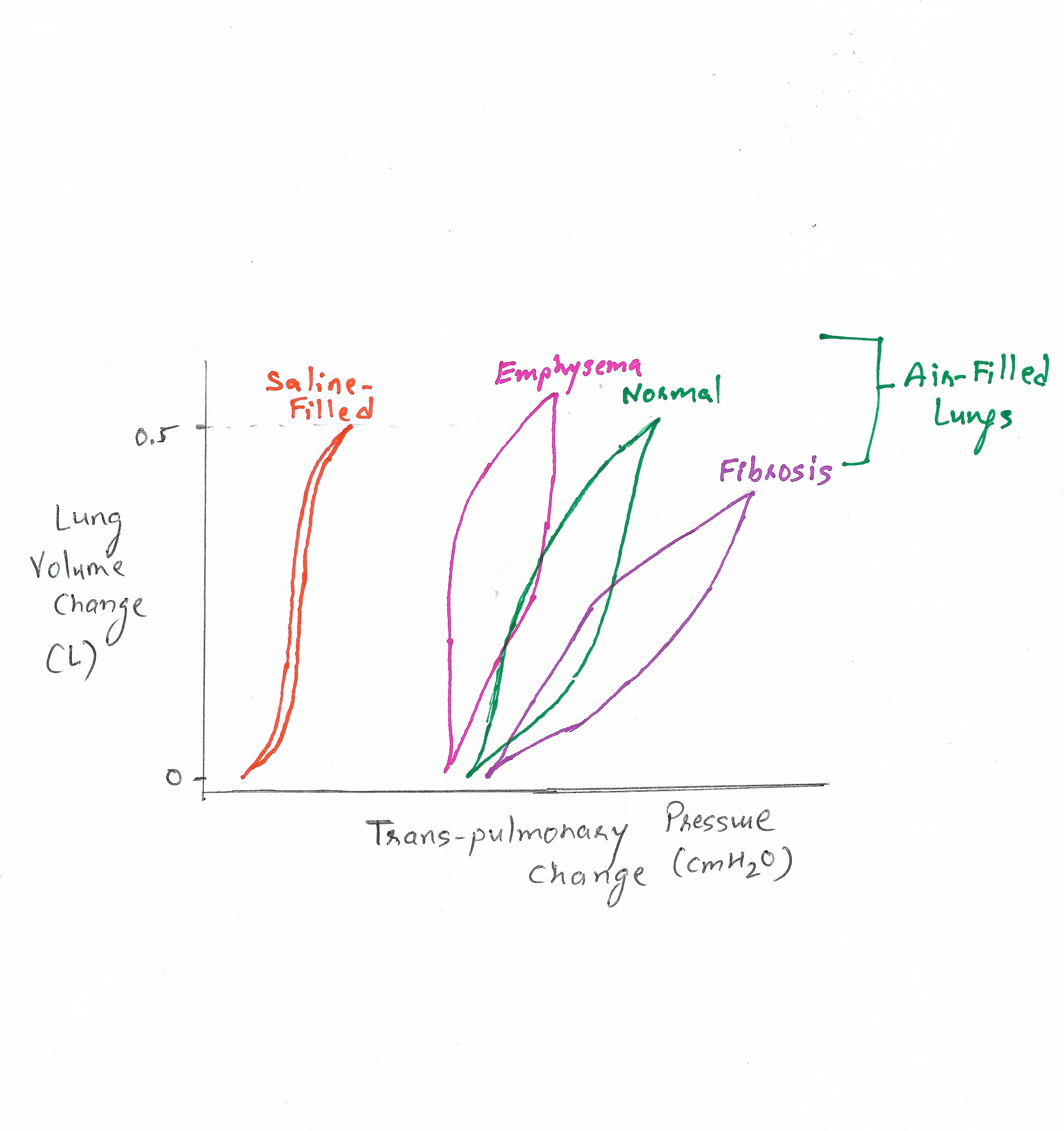 <p>Comparison of Lung Compliance Curves