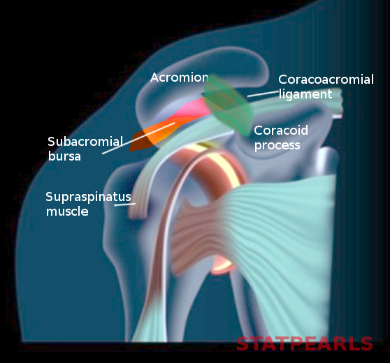 <p>Subacromial Bursa</p>